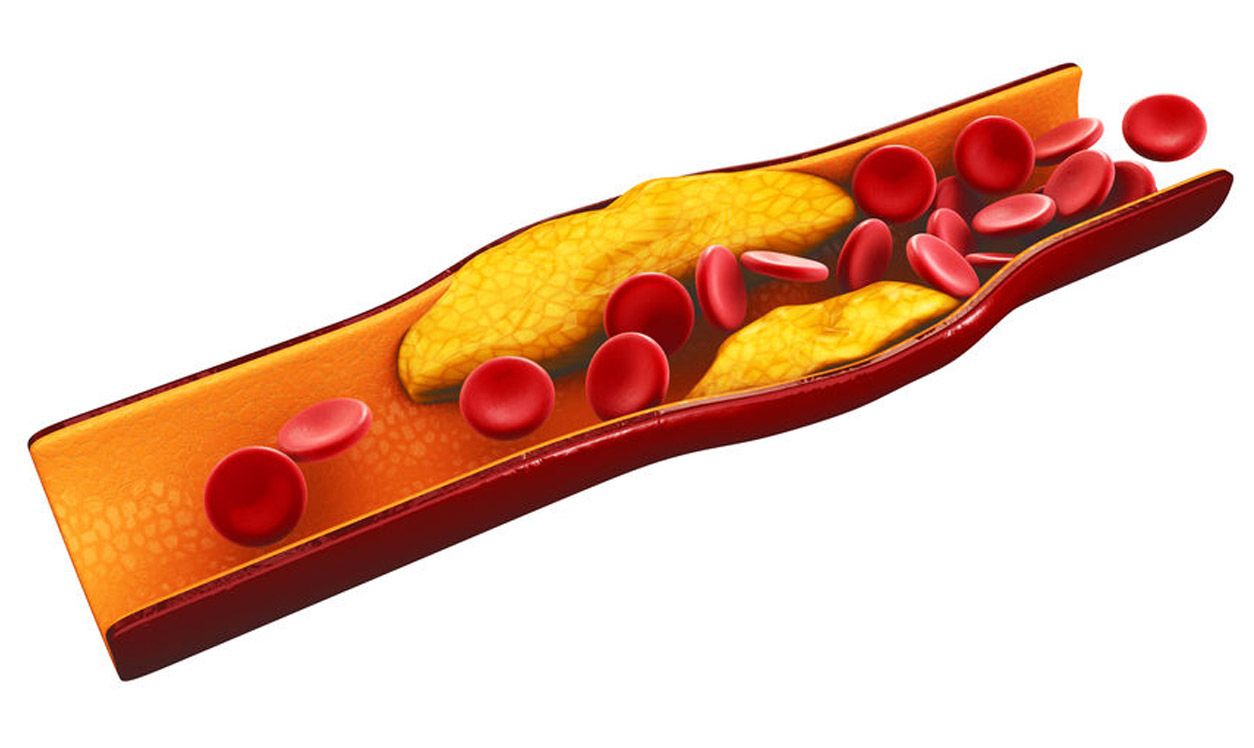 cholesterol